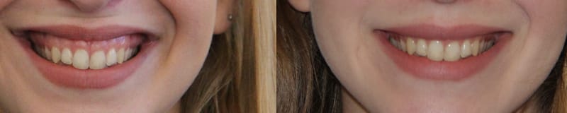 photos-chirurgie-esthetique-paris-medecine-esthetique-botox-7