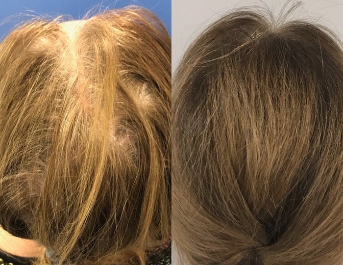 photos-chirurgie-esthetique-paris-medecine-esthetique-peau-1