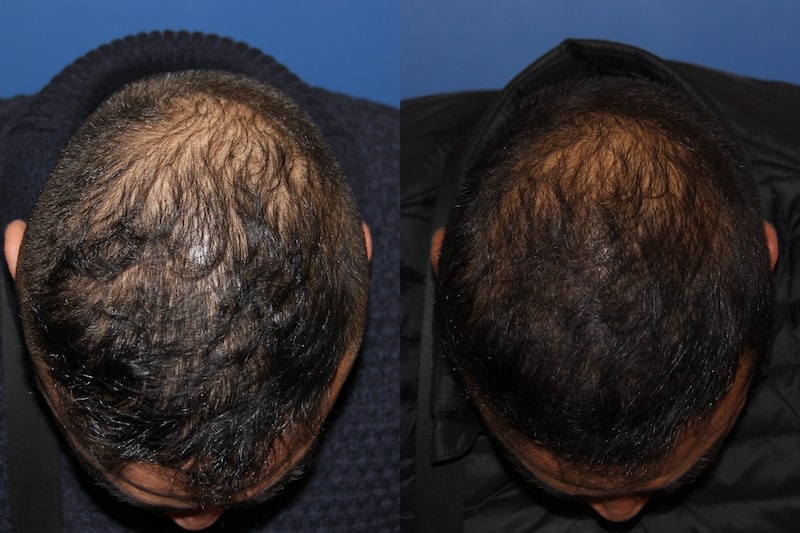 photos-chirurgie-esthetique-paris-medecine-esthetique-peau-2