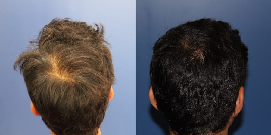 photos-chirurgie-esthetique-paris-medecine-esthetique-peau-3