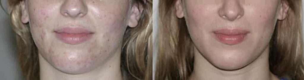photos-chirurgie-esthetique-paris-medecine-esthetique-peau-5