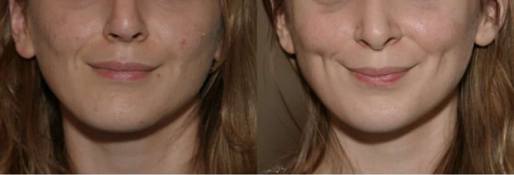photos-chirurgie-esthetique-paris-medecine-esthetique-peau-6