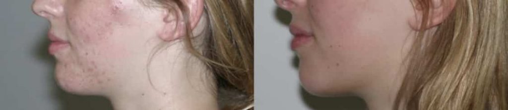 photos-chirurgie-esthetique-paris-medecine-esthetique-peau-7