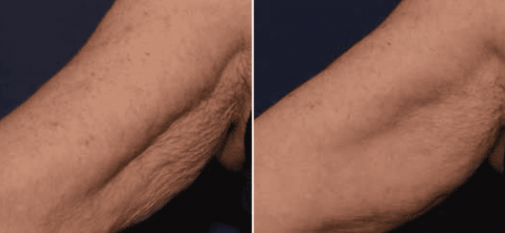 photos-chirurgie-esthetique-paris-medecine-esthetique-peau-8
