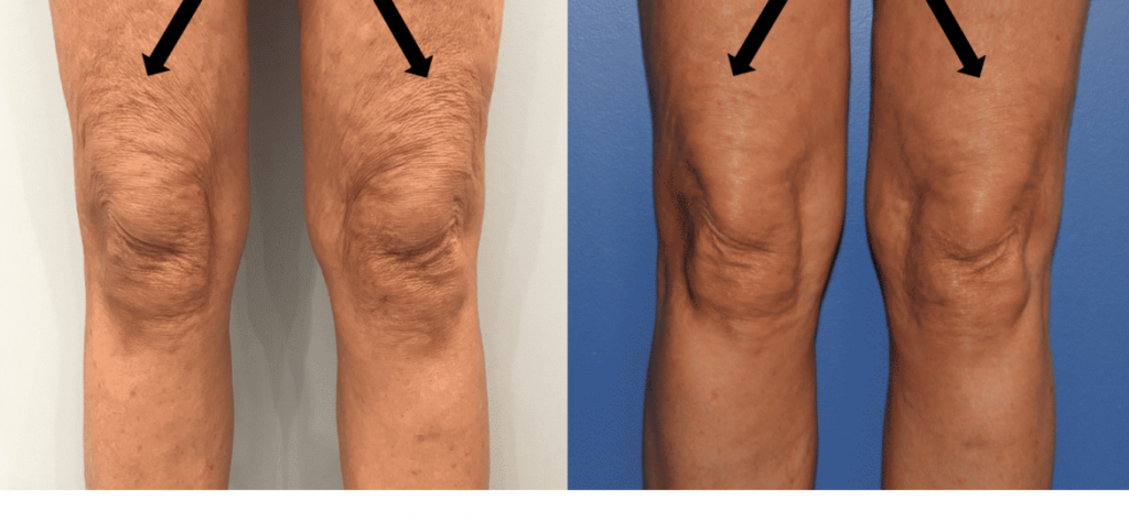 photos-chirurgie-esthetique-paris-medecine-esthetique-peau-9