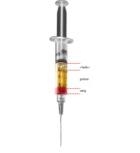 lipofilling paris