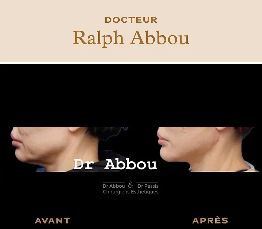 Chirurgie et médecine esthétique intime pour la femme - Dr Abbou