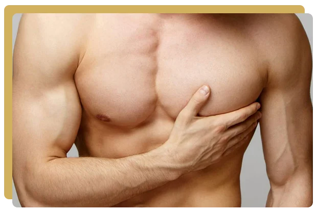 Gynecomastie paris