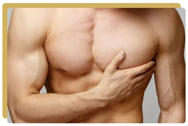 Gynecomastie