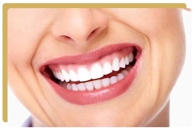 Traitement sourire gingival paris