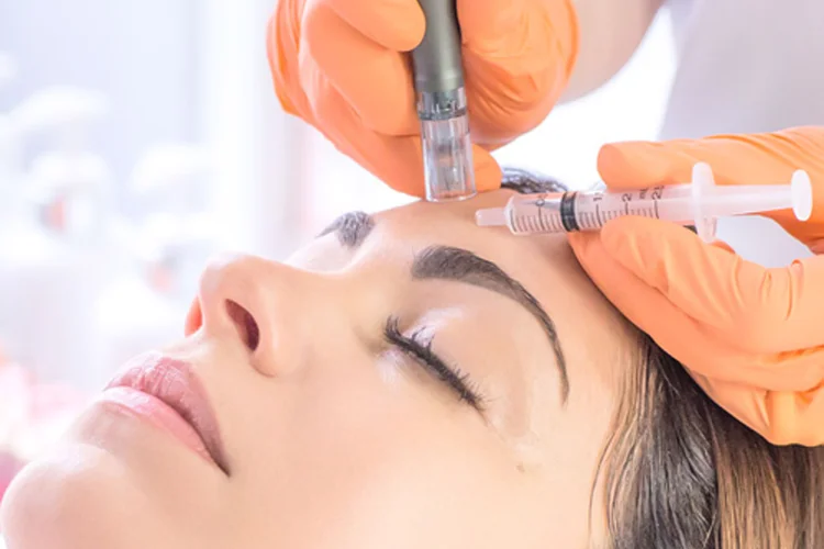 Microneedling visage paris