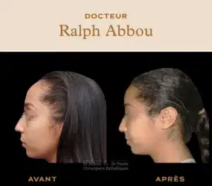 reduction du front paris