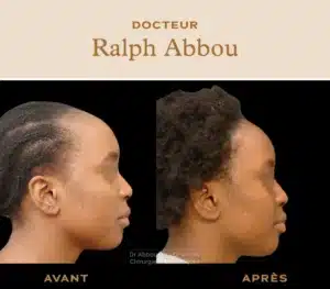 Réduction du front Paris