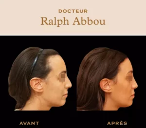 Réduction du front à Paris