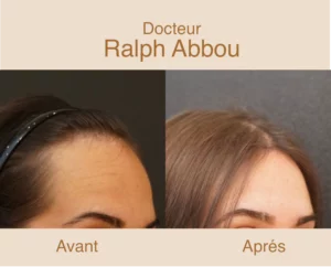 Reduction abaissement front paris