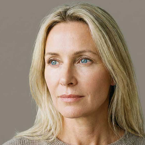 Deep Plane Face and Neck Lift by Dr Ralph Abbou in Dubai